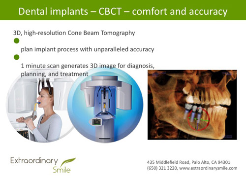 Palo Alto Digital Dental Implants