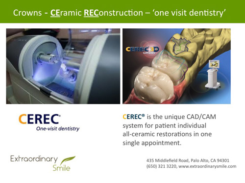 Palo Alto Cerec
